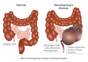 Diagram of the large intestine - full description below.