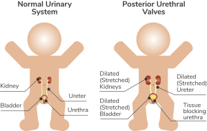 Diagram of the urinary system in boys - full description below.