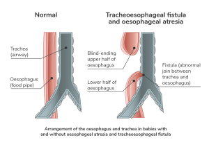 Diagram of the errangement of the oesophagus and trachea - full description below.